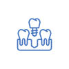 carga imediata com implantes dentarios