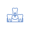 cirurgia guiada para implantes dentarios