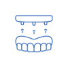 reabilitacao bucal com implantes dentarios